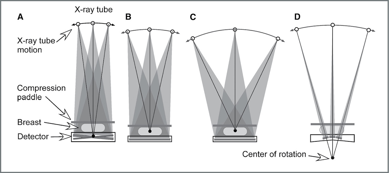 contrast enhanced digital breast tomosynthesis contrast enhanced digital breast tomosynthesis